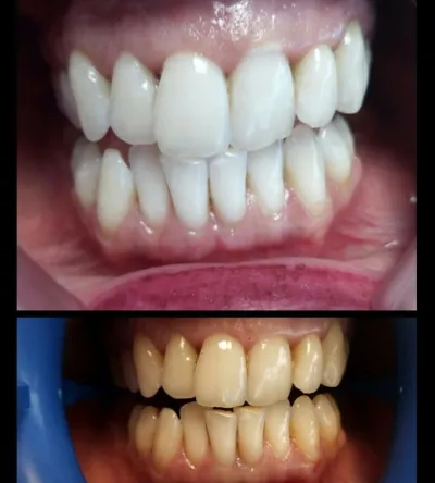 Dis Hekimi Hamit Coşkun Corlu Dent - Görsel 3