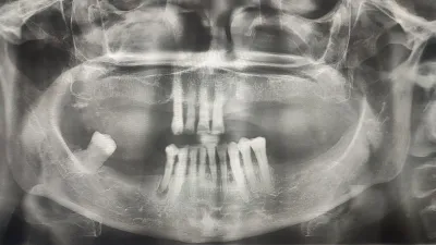 Dis Hekimi Hamit Coşkun Corlu Dent - Görsel 6