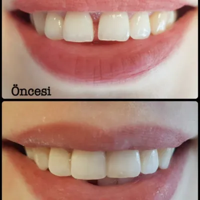 Dis Hekimi Hamit Coşkun Corlu Dent - Görsel 10